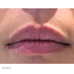 Lips Expertise training - Sunny lips