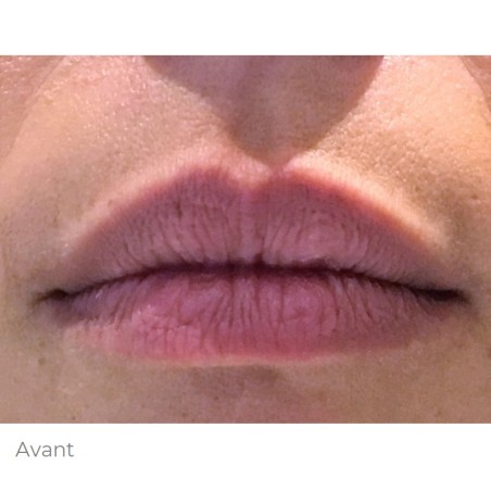 Lips Expertise training -...