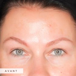 Brow expertise - Advanced Techniques