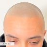 Scalp micropigmentation - Fondamental