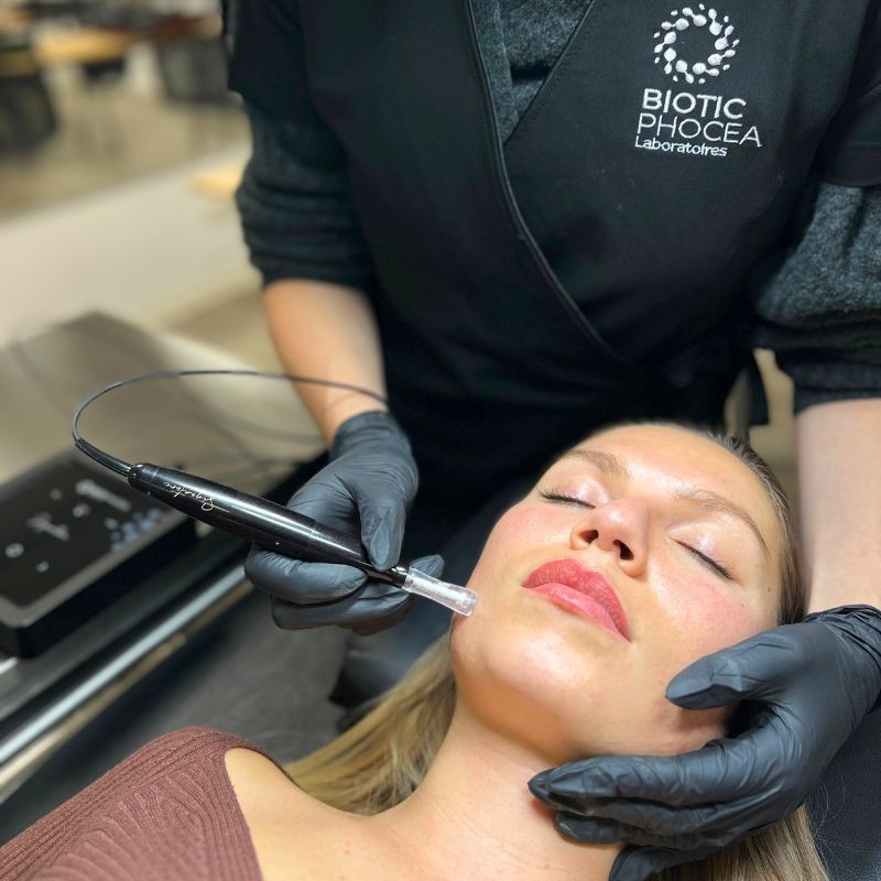Microneedling & BB glow