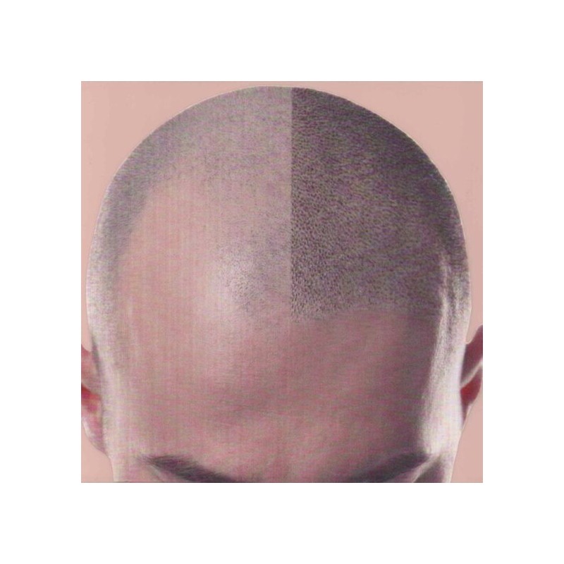 Peau en silicone Effet crâne rasé - Trichopigmentation