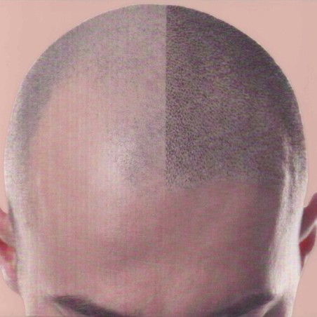 Peau en silicone Effet crâne rasé - Trichopigmentation