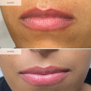 Papaya - Corrector - CC12 - Airless Color®