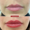 ColorLab Avant/Apres [D010-LIPS04]
